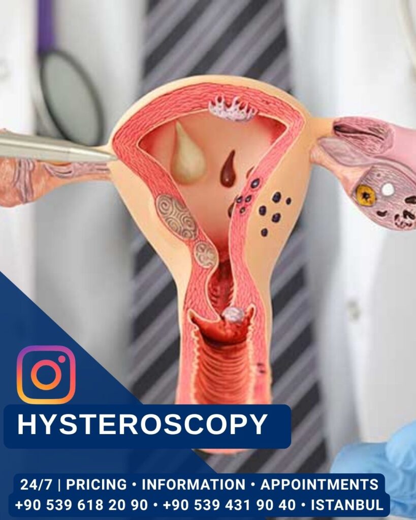 Home - Hysteroscopy - Aesthetic Surgery and Gynecology Clinic in Istanbul -
