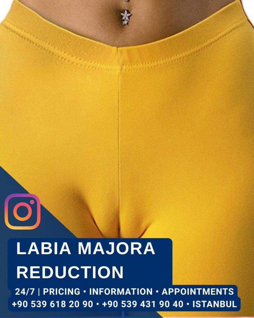 Home - Labia Majora Reduction 2 - Aesthetic Surgery and Gynecology Clinic in Istanbul -