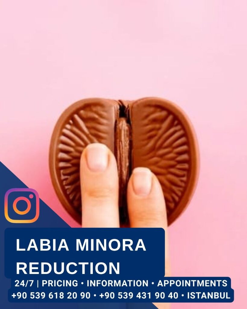 Home - Labia Minora Reduction - Aesthetic Surgery and Gynecology Clinic in Istanbul -