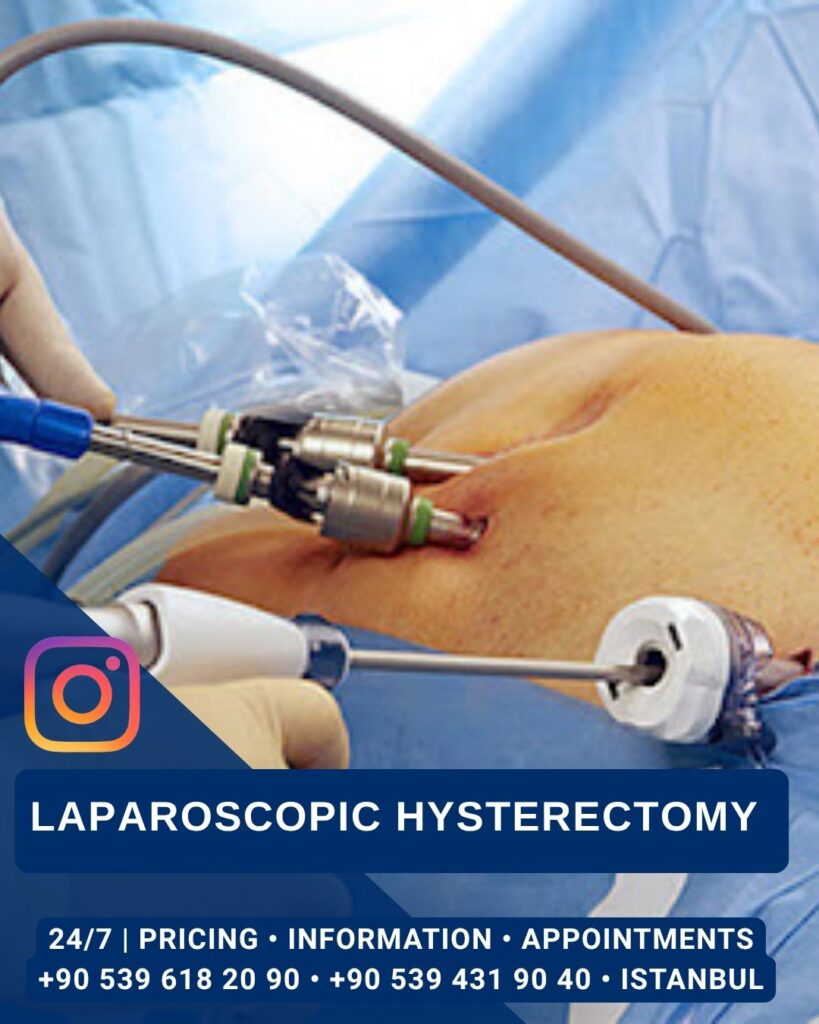 Home - Laparoscopic Hysterectomy - Aesthetic Surgery and Gynecology Clinic in Istanbul -