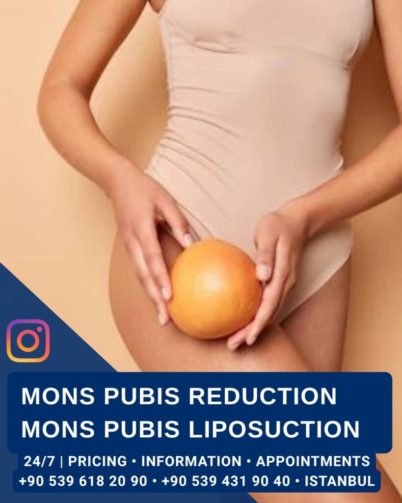 Home - Mons Pubis Reduction Mons Pubis Liposuction - Aesthetic Surgery and Gynecology Clinic in Istanbul -