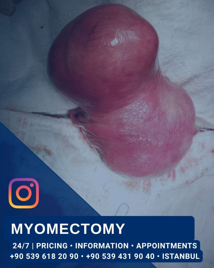 Home - Myomectomy - Aesthetic Surgery and Gynecology Clinic in Istanbul -