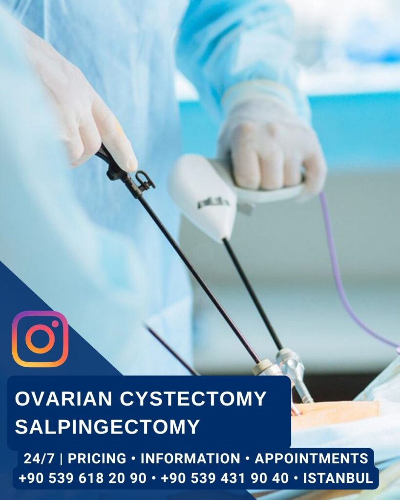 Home - Ovarian Cystectomy Salpingectomy - Aesthetic Surgery and Gynecology Clinic in Istanbul -